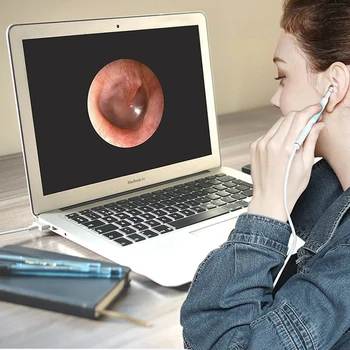Orelha Escolher Otoscópio Boroscópio Ferramenta de Cuidados de Saúde Na Limpeza de Ouvidos Endoscópio USB Visual Ouvido Colher de 5.5 mm Mini Câmera Para PC Android